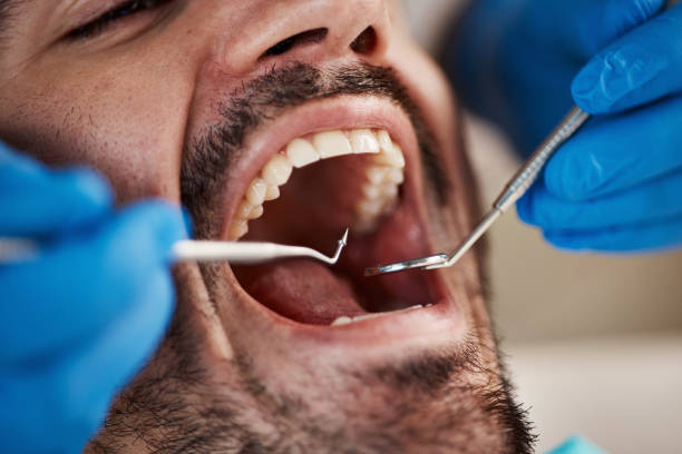 Urgent Tooth Repair in NY